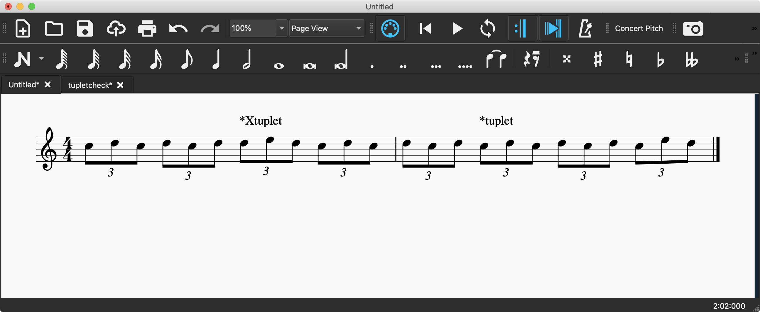 Adding tuplet interpretations in MuseScore